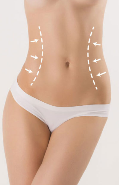 karin-germe1 karin-germe1